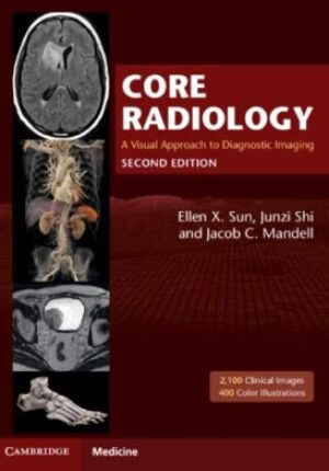 Core Radiology:A Visual Approach to Diagnostic Imaging ebook