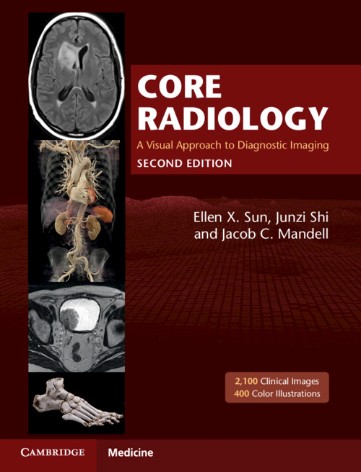 Core Radiology:A Visual Approach to Diagnostic Imaging ebook
